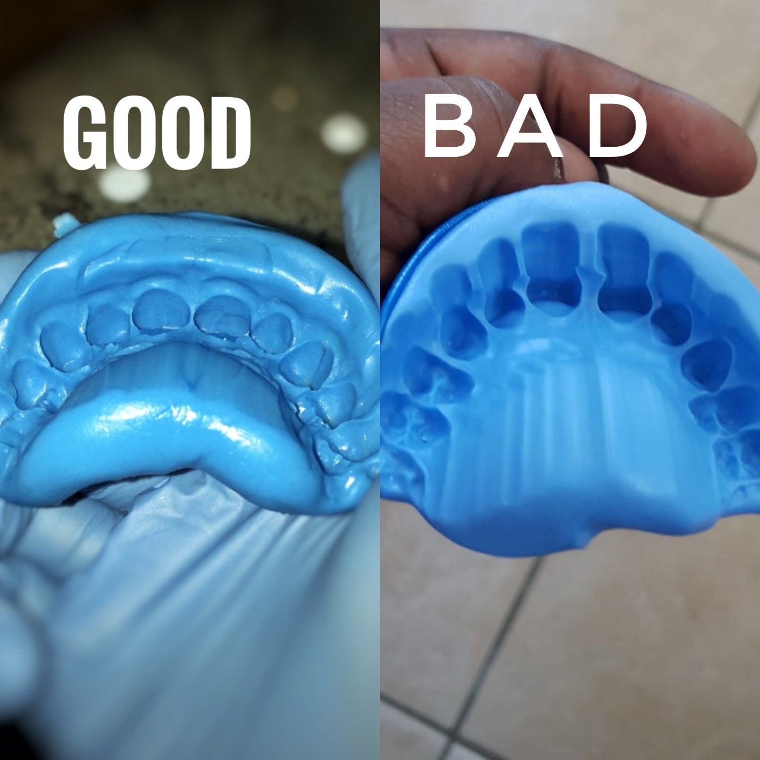 Mold kit for Custom Gold Grillz / Dental Teeth Impression /  Grillz Mold Kit / Dental Use . 2 Kit each set for same price as One - GrillzCity