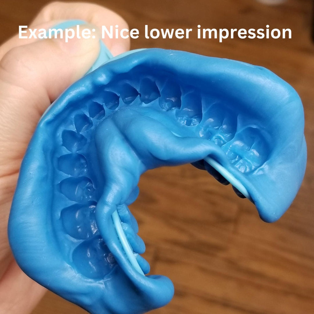 Mold kit for Custom Gold Grillz / Dental Teeth Impression /  Grillz Mold Kit / Dental Use . 2 Kit each set for same price as One - GrillzCity 