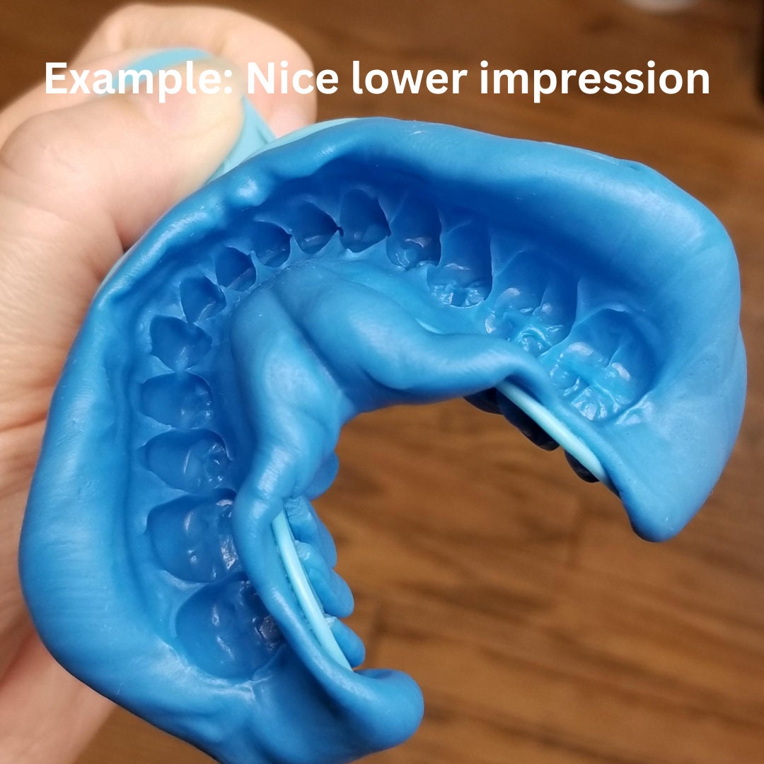 Mold kit for Custom Gold Grillz / Dental Teeth Impression /  Grillz Mold Kit / Dental Use . 2 Kit each set for same price as One - GrillzCity 