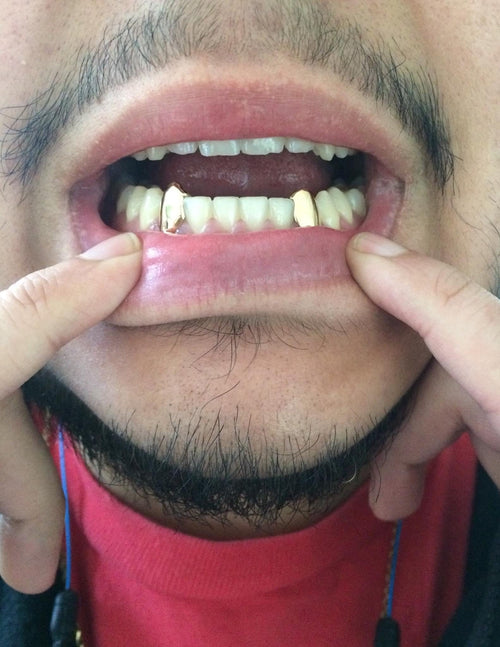 Custom Fit grillz  2 Teeth Gold Grillz fangs / 925 Silver Slugs Grillz , grillz with fangs / Vampire grillz with free mold kit free shipping - GrillzCity 