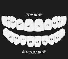 Custom Fit grillz  2 Teeth Gold Grillz fangs / 925 Silver Slugs Grillz , grillz with fangs / Vampire grillz with free mold kit free shipping - GrillzCity 