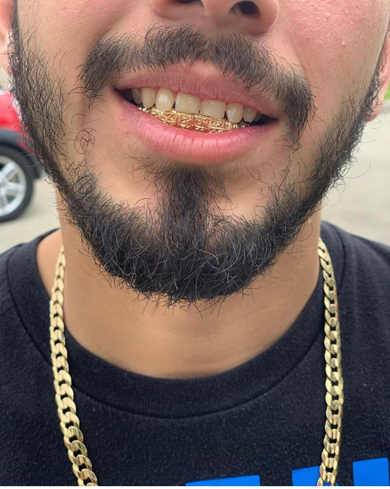 Diamond Dust Gold Grillz Starburst Cut / Dust Cut Grillz with free mold kit and shipping - GrillzCity 