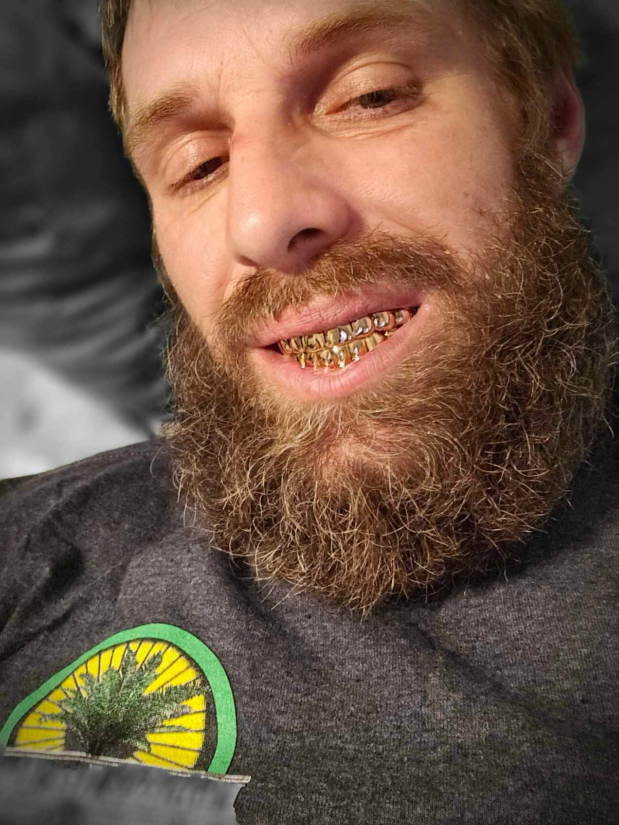 Custom Gold & Silver Grillz - Permanent & Deep Cut Designs - GrillzCity 
