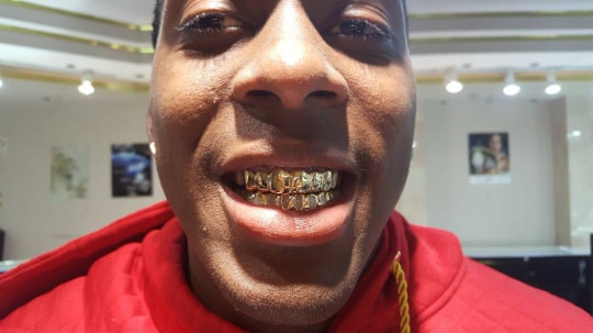 Custom-handmade  White / Yellow  Gold & Silver Custom Grillz Open face Diamond dust cut with FREE MOLD KIT and Free Shipping  - Grillzcity - GrillzCity 