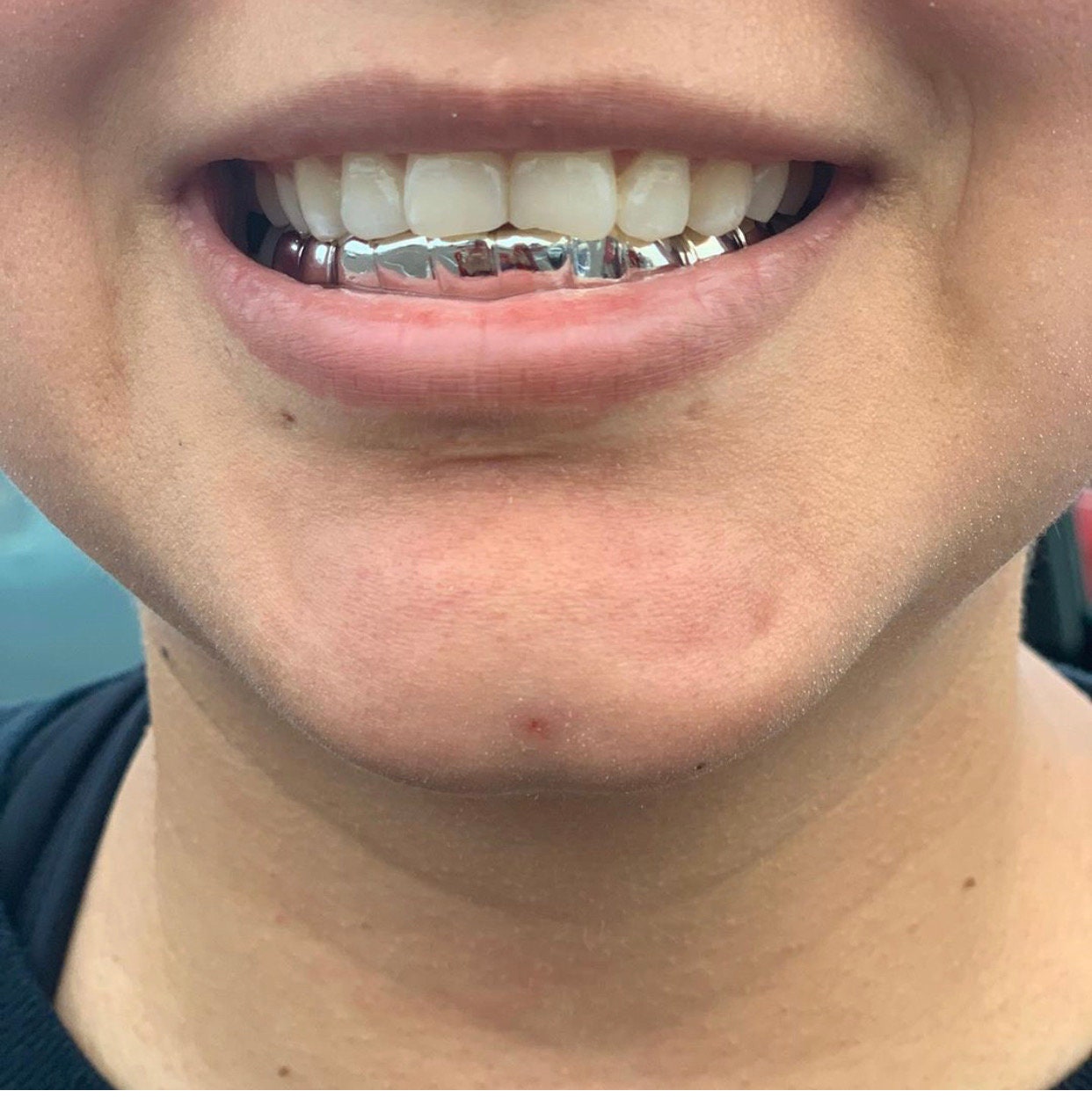 Custom solid 10K - 14K REAL Gold Teeth Grillz / 925 Silver Grillz, Permanent Cut / Deep Cut Grillz with free mold kit and shipping included - GrillzCity 