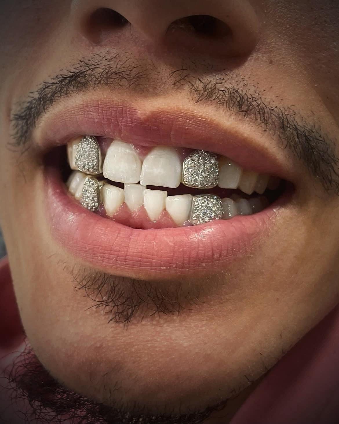 Custom Fit Grillz in Real Gold or 925 SILVER honeycomb handset fully iceoutGrillz with VVS Moissanite by GrillzCity - GrillzCity 